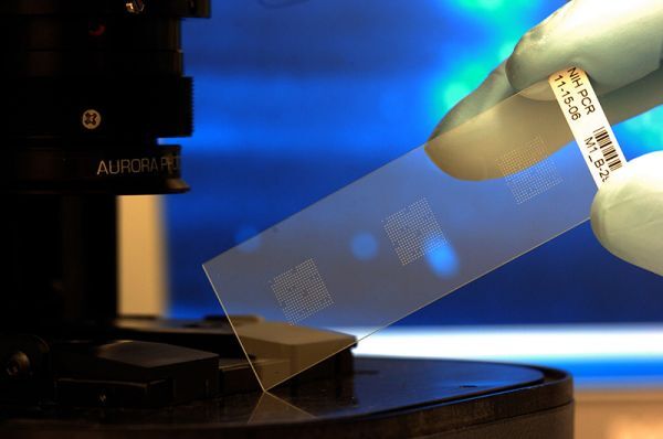 Ống cảm biến sinh học nano carbon dùng để chẩn đoán, điều trị bệnh