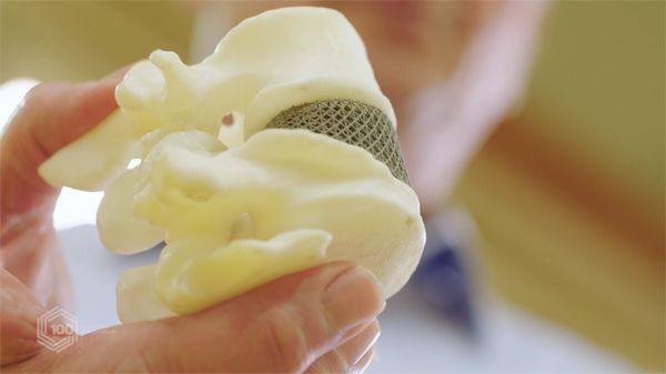 in 3D, y tế thông minh, Thiết bị cấy ghép, RMIT, ĐH RMIT, đĩa đệm cột sống, cấy ghép mô,