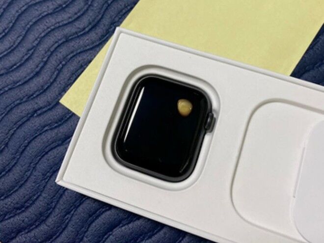Apple Watch SE bị quá nhiệt làm bỏng cổ tay, hỏng màn hình