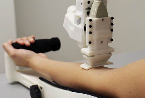 Robot lấy máu có tỷ lệ chính xác cao hơn con người