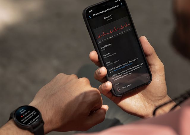 Ứng dụng Điện tâm đồ (ECG) của Garmin đã có thể sử dụng tại Việt Nam