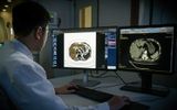 Trợ lý AI DrAid tham gia chẩn đoán hình ảnh và sàng lọc bệnh