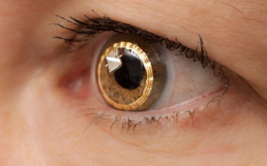 Thị trường kính áp tròng thông minh: rộng mà hẹp