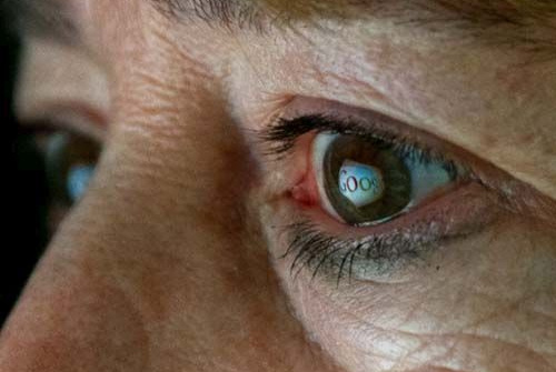 Google nhận bằng sáng chế kính áp tròng cấy trong giác mạc