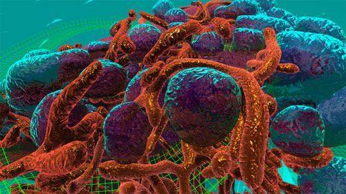 Ứng dụng công nghệ thực tế ảo để "khắc chế" ung thư