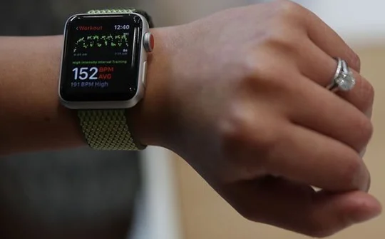 Apple Watch Series 3 bị treo khi được hỏi về thời tiết