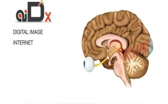Nam Phi phát triển hệ thống nhận dạng sử dụng trí tuệ nhân tạo