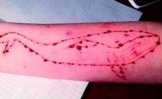 Tựa game di động Blue Whale khiến nhiều bạn trẻ tự sát