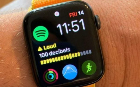 Apple Watch sắp có tính năng giúp bảo vệ thính giác của người dùng