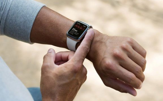 Apple Watch Series 5 (2019) có gì đặc biệt