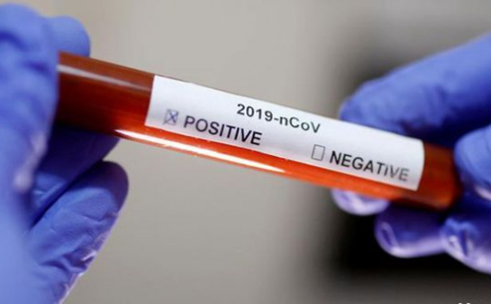 Có thể hy vọng vào khả năng của AI trong phòng ngừa và ngăn chặn dịch bệnh