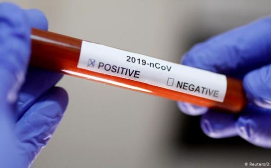 Microsoft góp sức nghiên cứu cách hệ miễn dịch phản ứng với Covid-19