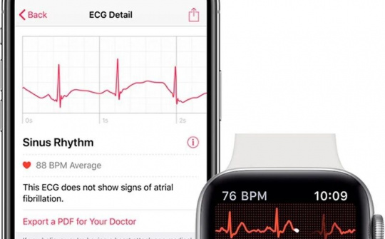 Apple bị kiện vì độc quyền thị trường theo dõi sức khỏe