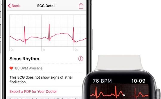 Apple bị kiện vì độc quyền thị trường theo dõi sức khỏe