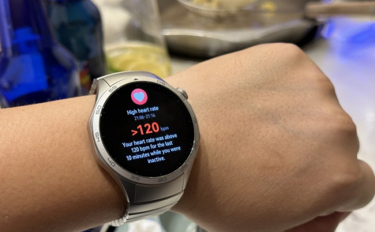 Smartwatch dần chiếm ưu thế so với đồng hồ truyền thống