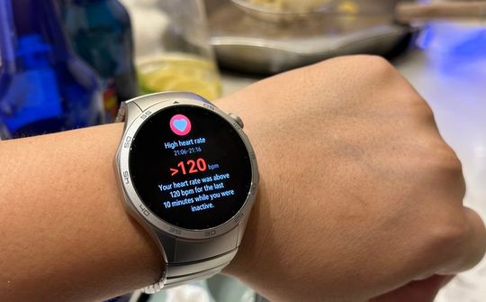 Smartwatch dần chiếm ưu thế so với đồng hồ truyền thống