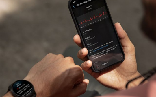 Garmin ra mắt ứng dụng Điện tâm đồ (ECG)