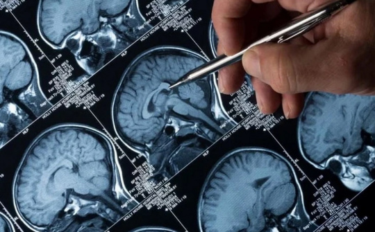 Công nghệ mới giúp phát hiện các khối u ác tính chính xác hơn